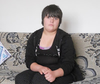 Vajze me Sindromin Down